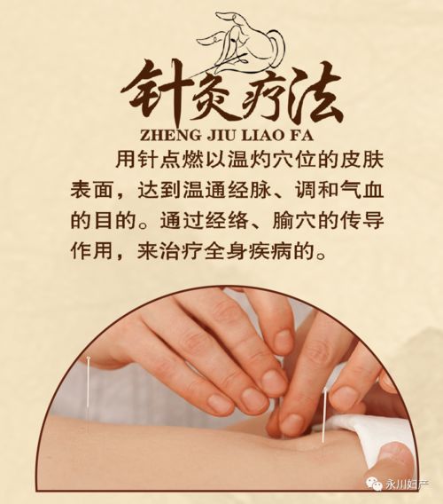 永川妇产医院中医科11月3日开诊,超大福利即将呈现